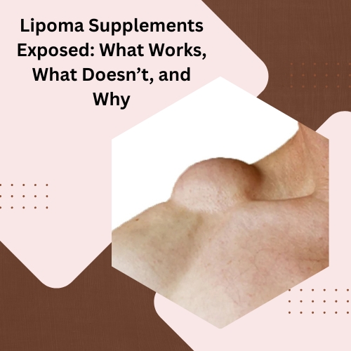 Lipoma Supplements Exposed