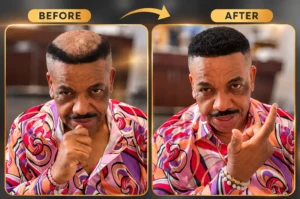 Hair Fixing