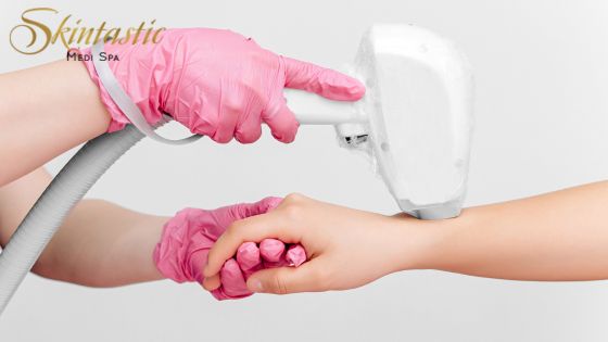 Laser Hair Removal in Riverside