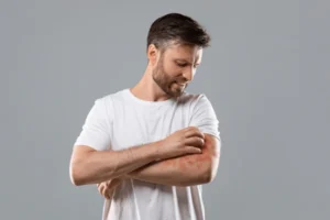 Fenbendazole 150 mg: Powerful Antiparasitic Solution for Human Health
