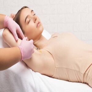 Laser Hyperhidrosis Treatment in Riyadh: A Long-Term Solution for Excessive Sweating
